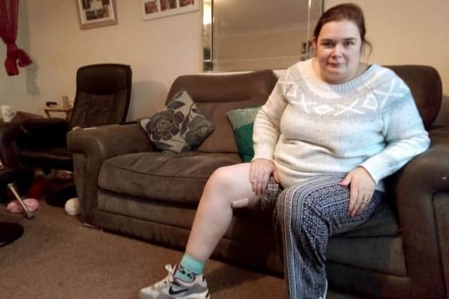Marie Hind, 34, from Gosport, was bitten by a spider
