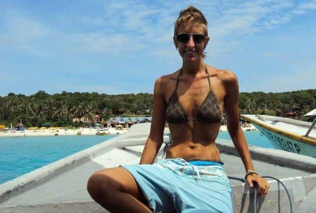 Natalie Wallis, who has not eaten a meal for eight years due to a stomach condition