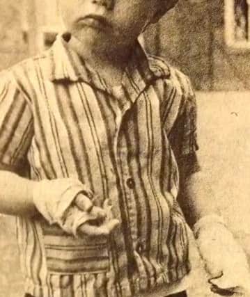Two-year-old Barry Dartnell with bandaged hands