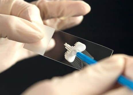 A smear test