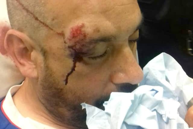 Andy Carpenter in hospital after the attack