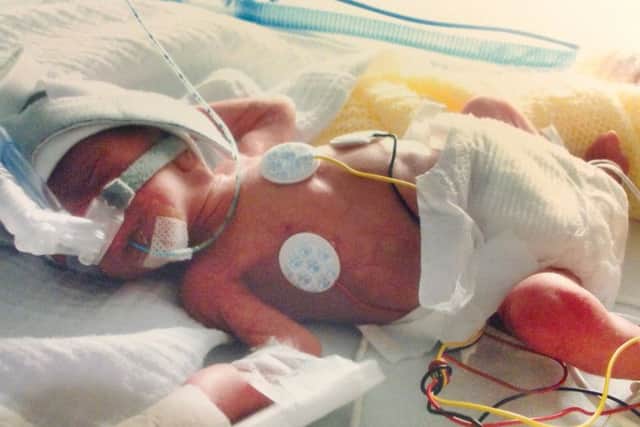 Isla Kay while still in hospital