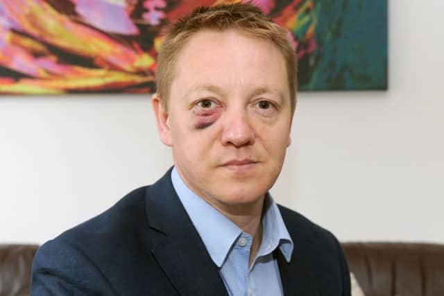 Martin Smith was attacked by two teenage boys in Seafield Park in Stubbington
Picture: Sarah Standing (170479-9574)