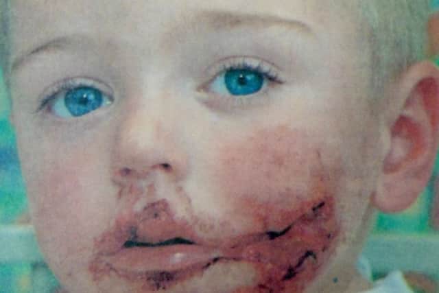 Two-year-old Alfie Wake was left bloodied and traumatised following the dog attack in Paulsgrove. PPP-170418-121254001