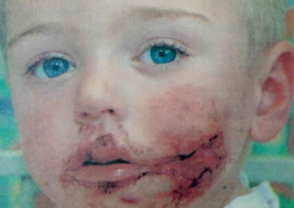 Two-year-old Alfie Wake was left bloodied and traumatised following the dog attack in Paulsgrove. PPP-170418-121254001