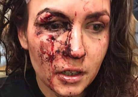 Faye Sharpe, 24, who was attacked by Karl Gates.