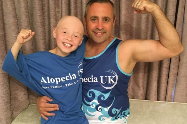 Steve Grant with his daughter Hollie, who has alopecia
