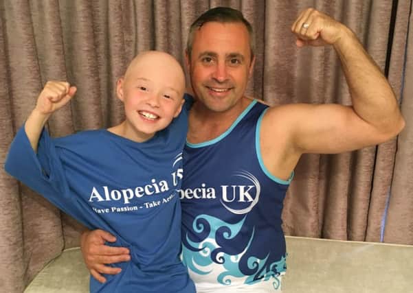 Steve Grant with his daughter Hollie, who has alopecia
