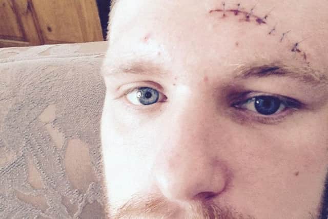 The head wound