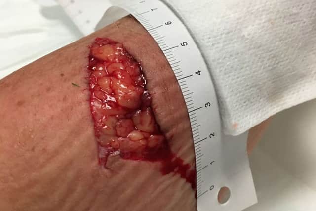 PC Danielle Ruzewic's injury