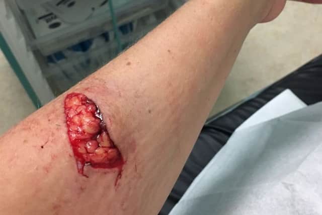Danielle Ruzewic's injury