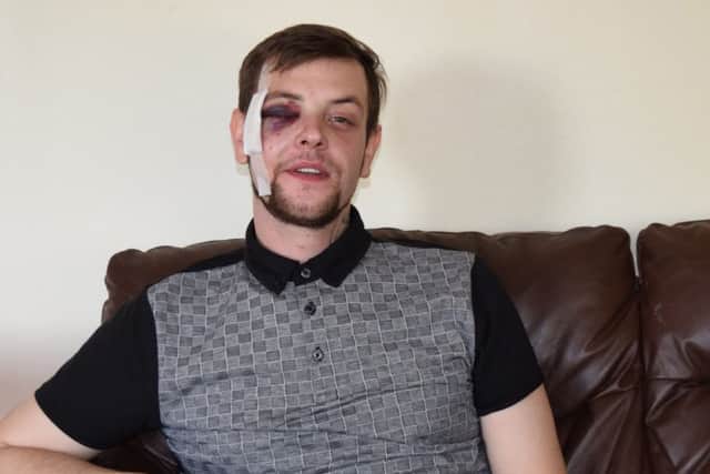 Josh Andrews, 28, of Strode Road, Stamshaw

who was punched with a knuckle-duster at a Halloween party at the Mother Shipton pub