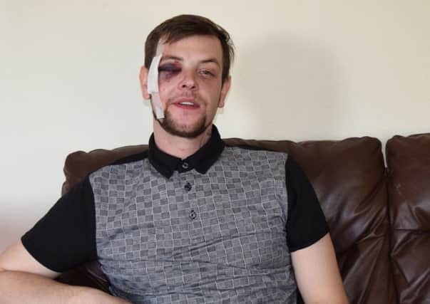 Josh Andrews, 28, of Strode Road, Stamshaw

who was punched with a knuckle-duster at a Halloween party at the Mother Shipton pub